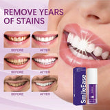 Smile Ease | ابتسامة سهولة