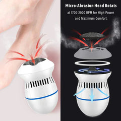 Electric Callus Remover | مزيل الجلد الميت الكهربائي