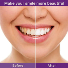 EELHOE PURPLE TOOTHPASTE